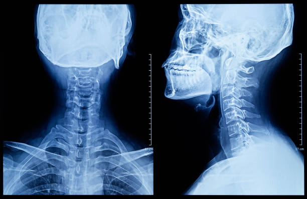 Spine X-Ray