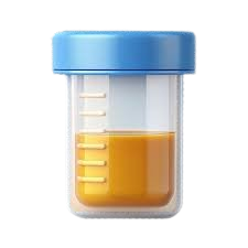 Urine Test